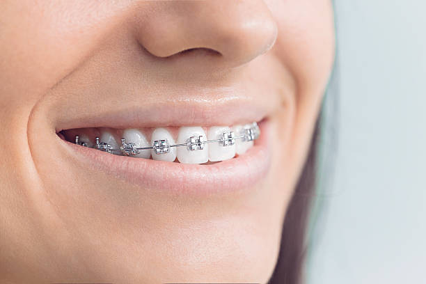 Best Dental Inlays and Onlays  in Wakeeney, KS